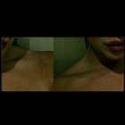 MII.AOU }:{ 3LC thumbnail