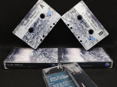 Vinyl & cassette bundle photo 