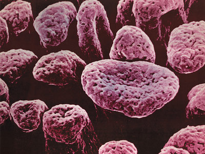 Controlled Bleeding Body Samples 2lp Vinyl Warehouse Finds