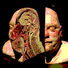 splitdecision thumbnail