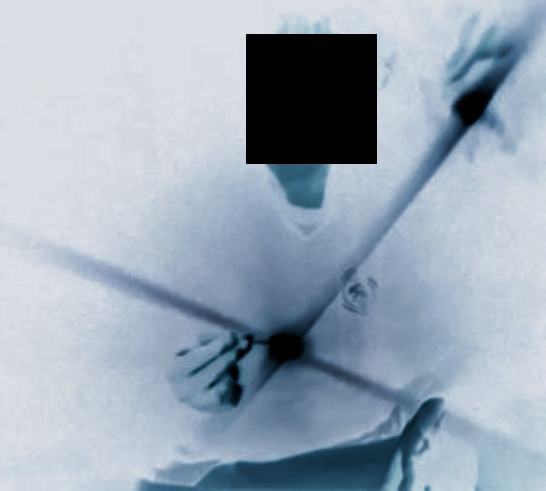 A Wounded Pool Of Fire Aspen House