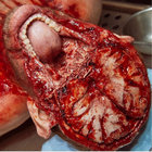 Skin Peeler  thumbnail