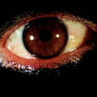 Alberto Picciau thumbnail