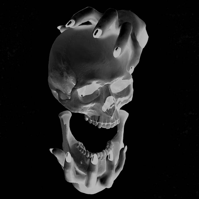 Occult Fracture — Photo