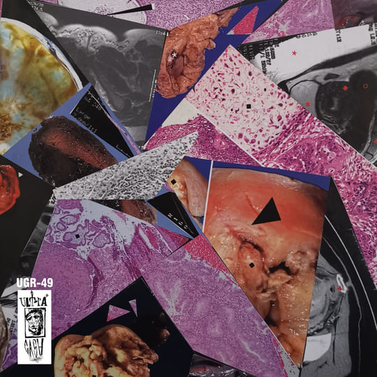 Genus Venses | Maurizio Bianchi / M.B. & Sacher-Pelz | Ultra Gash