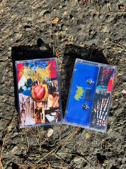 Harvest Of The Killing Fields | Trichomoniasis