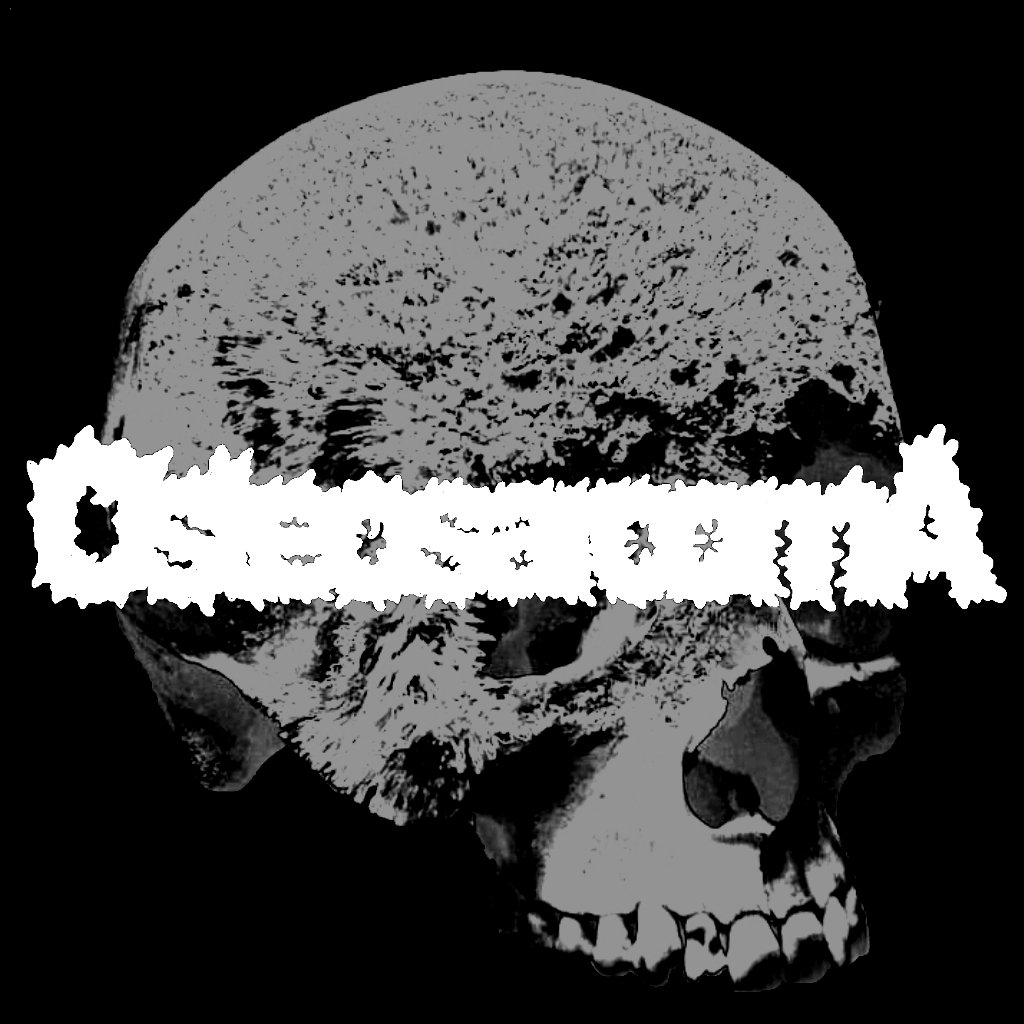 Demo 2024 Osteosarcoma demo-2024-osteosarcoma