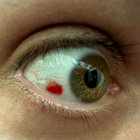 mjdt thumbnail