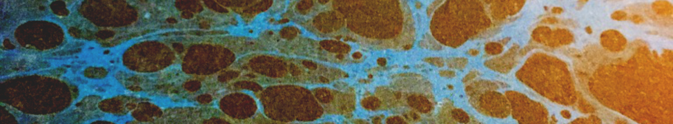 Body Party Body Party Mild Peril Recordings