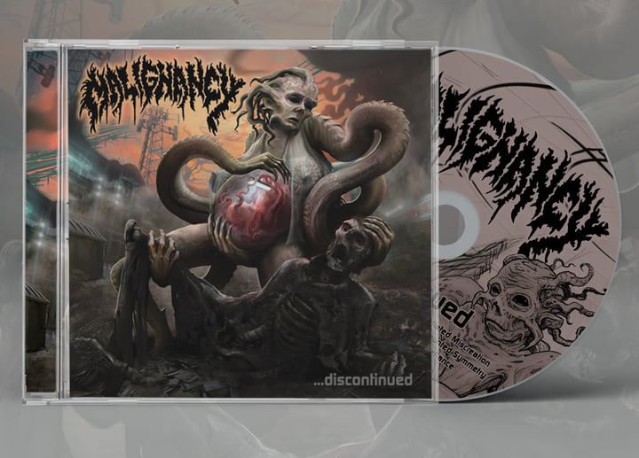 Discontinued | Malignancy