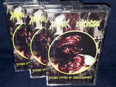 CARCINOSIS / MEATSHIELD: Altered States of Goresciousness - Split Tape photo 