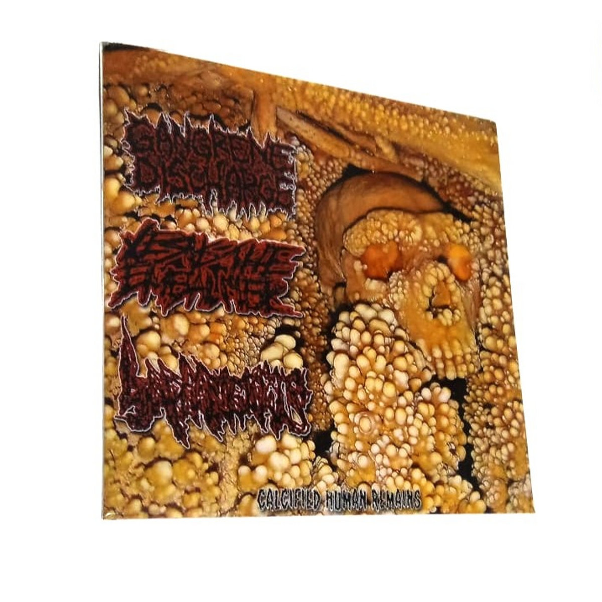 Calcified Human Remains w/ Gangrene Discharge Jesus The Embalmer