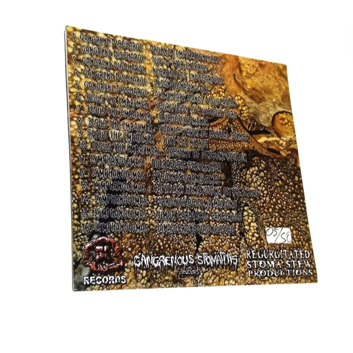 Calcified Human Remains w/ Gangrene Discharge Jesus The Embalmer