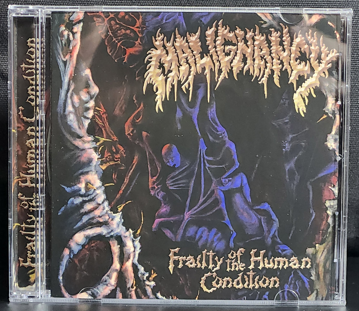Frailty of the Human Condition | Malignancy