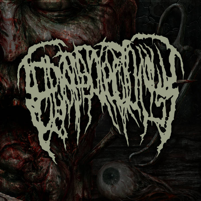 Music | EPICARDIECTOMY