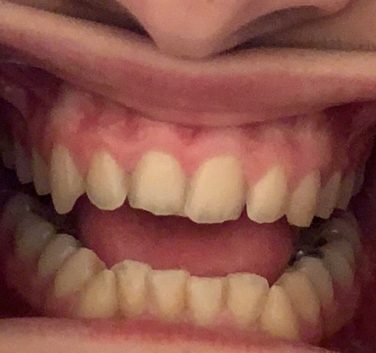 ART OF NAILS MAGTOOFERS