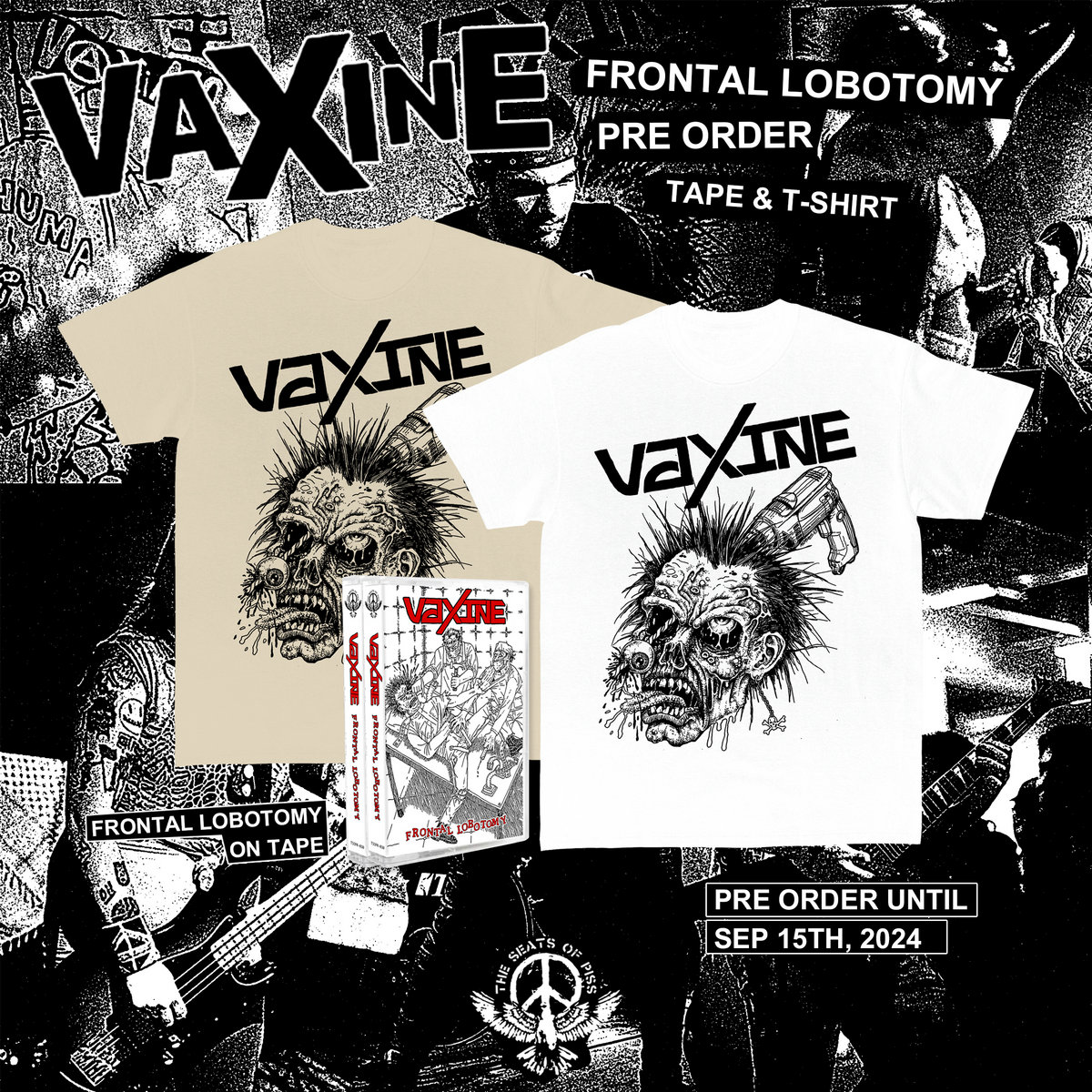 Technic of Prefrontal Lobotomy in: Journal of Neurosurgery Volume 5 Issue 6  (1948) Journals, image size:1200x1200