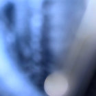 silkheaded thumbnail