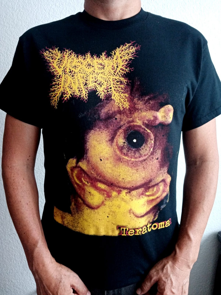 VISCERA INFEST “Teratoma” | American Line Prods