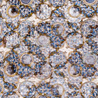 tapis barbu  thumbnail