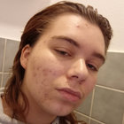 bird_boy thumbnail