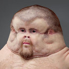 mdmtek thumbnail