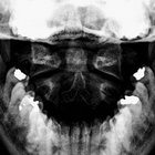 SPINAL AXIS thumbnail