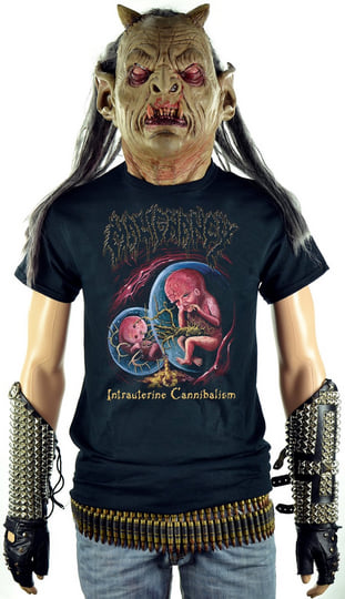Intrauterine Cannibalism | MALIGNANCY