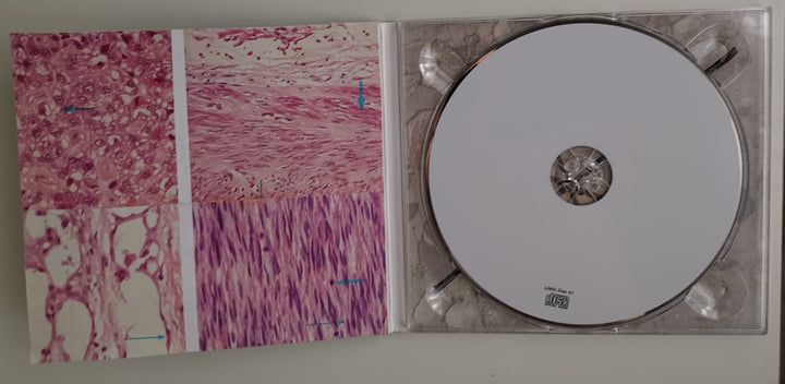 洋楽 Carcinosi Maurizio Bianchi M.B. 洋楽 Carcinosi Maurizio Bianchi M.B. Maurizio Bianchi – Soundohm