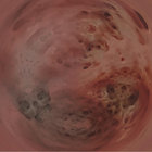 C thumbnail