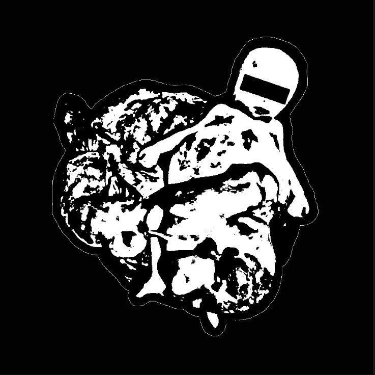 Split With Ulcerative Colitis | xLITHOPEDIONx