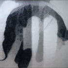 whistlinhollow thumbnail