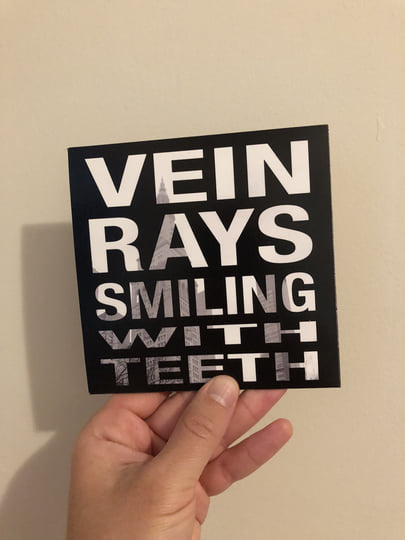 Smiling With Teeth | Vein Rays
