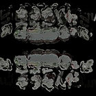 fumcssia thumbnail