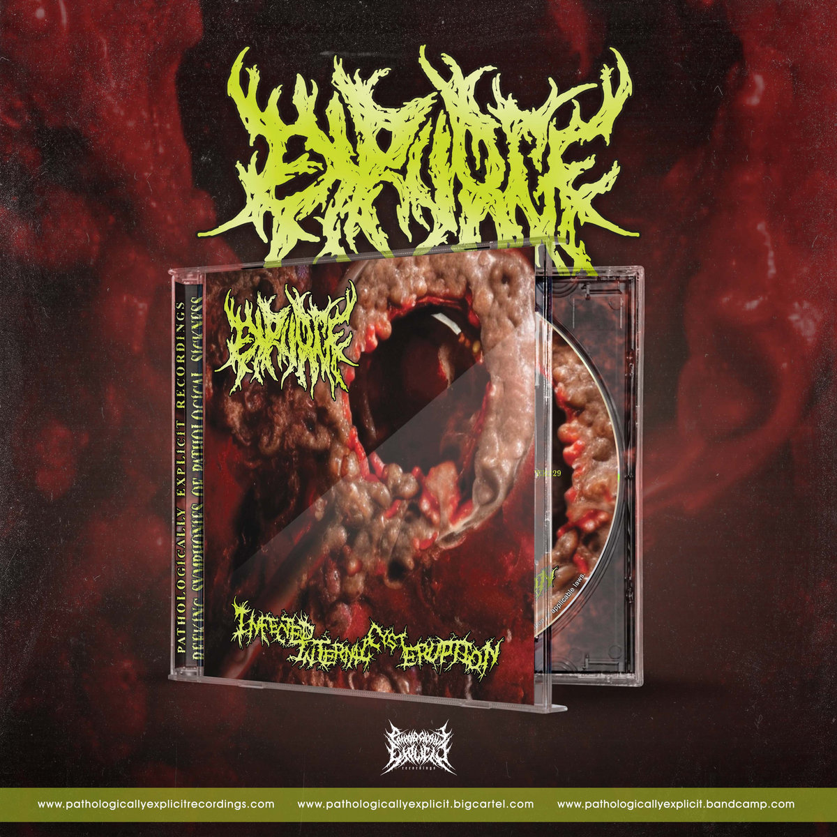 Expurge - Infected Internal Cyst Eruption | Pathologically Explicit