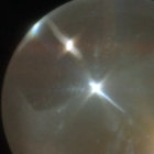 fix n stars  thumbnail