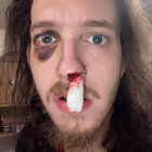 mikelovesnoise thumbnail