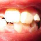 nikotiini thumbnail