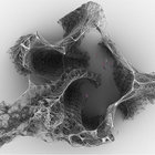 ‎‎malarone thumbnail