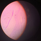 arg-gut thumbnail