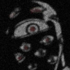 zydp thumbnail