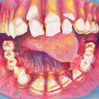 tubodigomma thumbnail