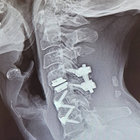 Obstacle of Affliction thumbnail
