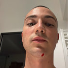 yungfoglia thumbnail