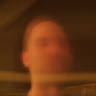 Tubuehlerosis thumbnail