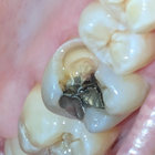 absentjean thumbnail