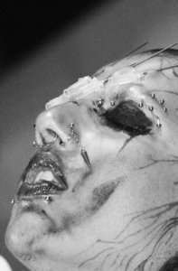 dagger wound