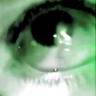pcnxo thumbnail