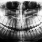éloi thumbnail
