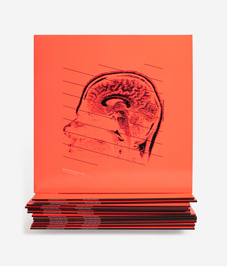 FIGHT FIRE WITH FIRE | JOACHIM NORDWALL | iDEAL Recordings